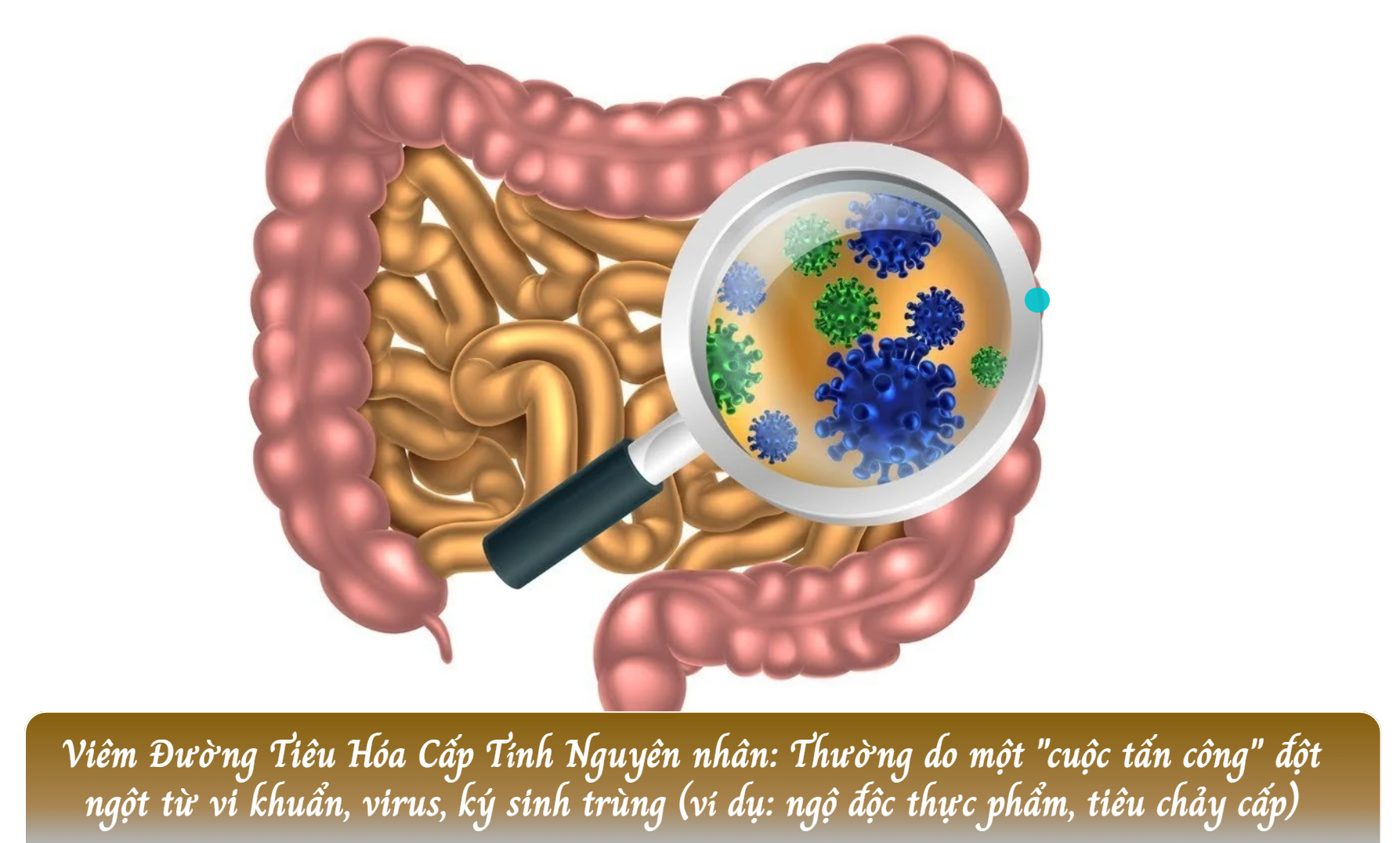 triệu chứng Viêm đường tiêu hóa