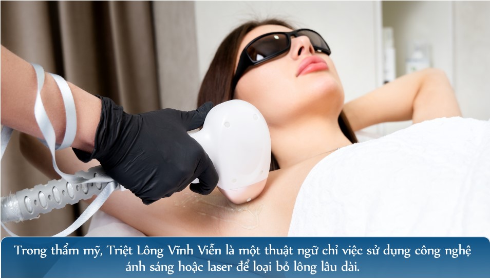 Triệt lông vĩnh viễn