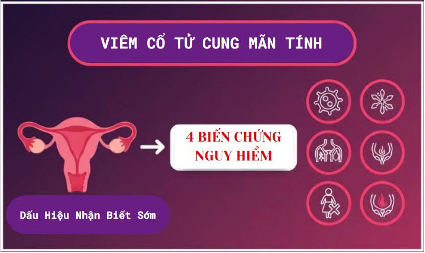 Viêm cổ tử cung mãn tính